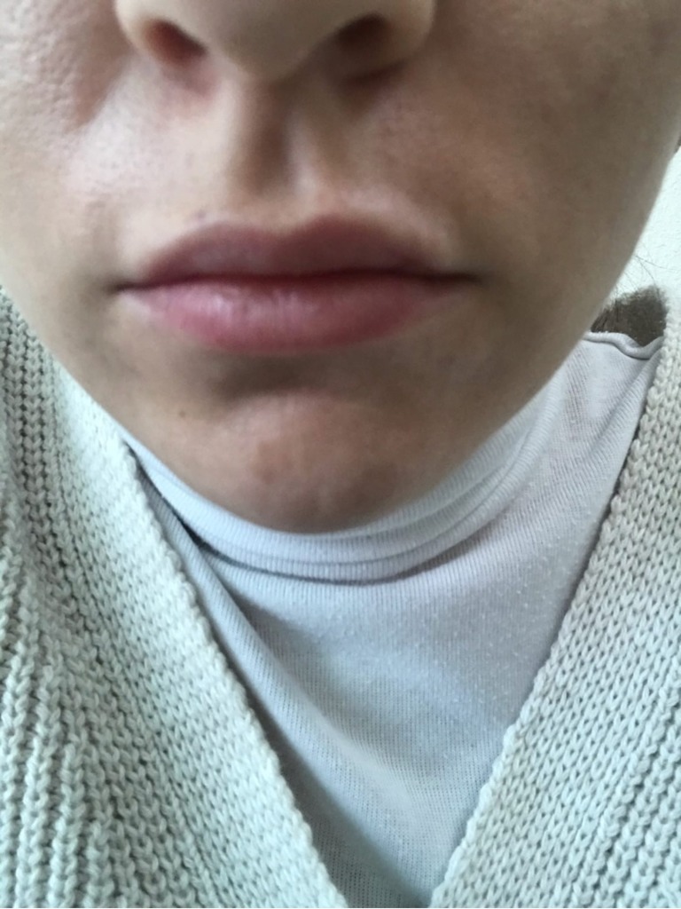 Фото 1. Как можно исправить ситуацию?