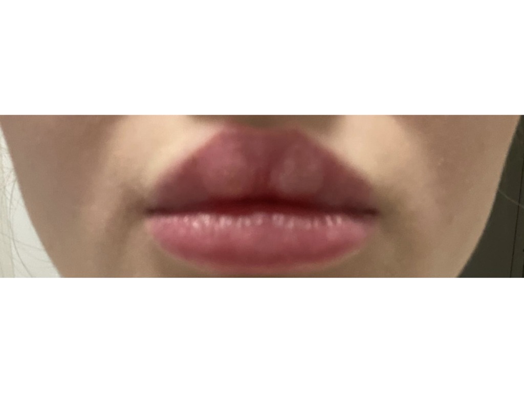 Фото 1. На сколько это опасно и как исправить?