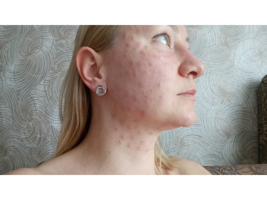 Фото 1. Как мне лечится, что это может быть?