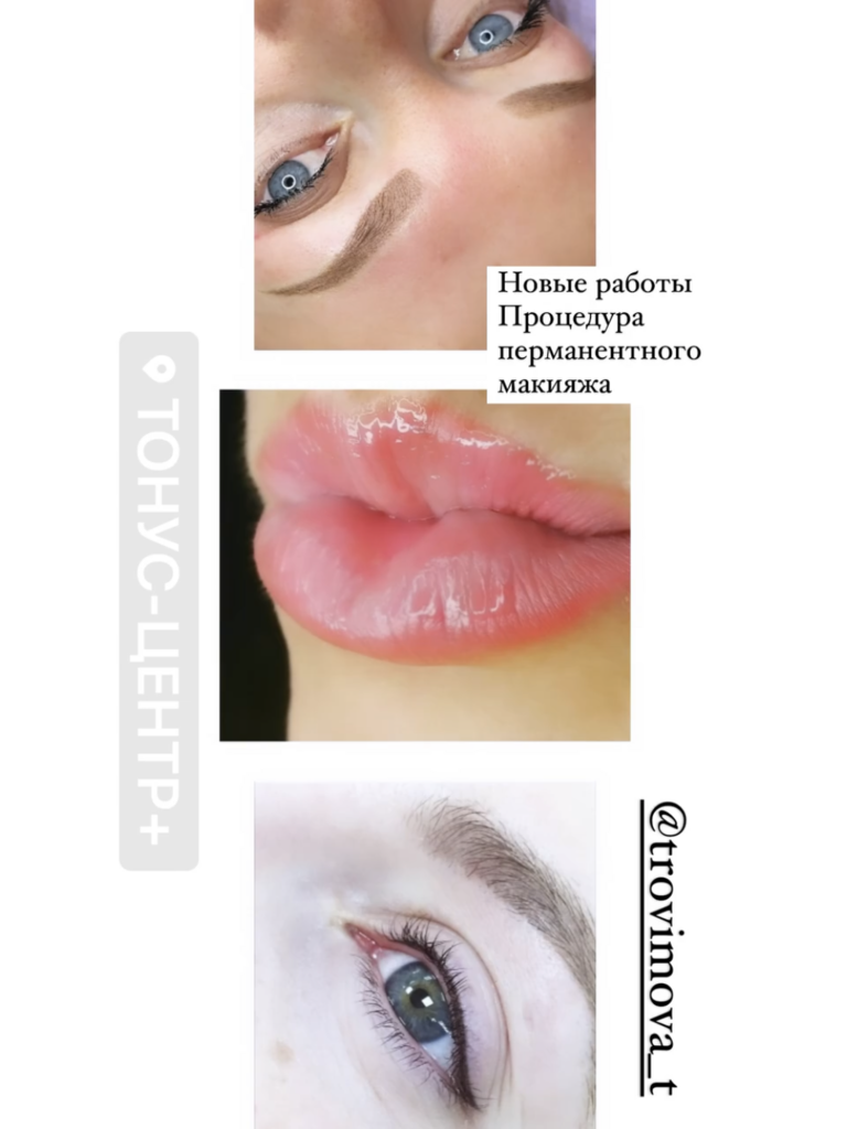 Фото 1. Опасно ли выводить гель из губ лидазой?