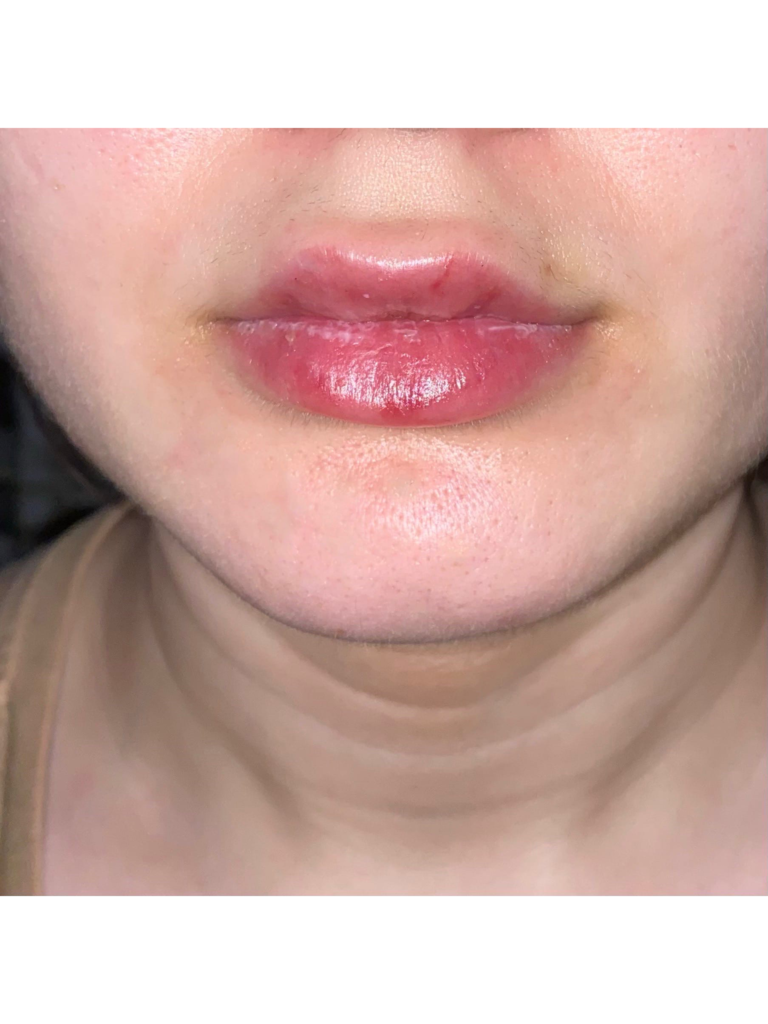 Фото 1. Помогите разобраться, что это - особенность или миграция геля?