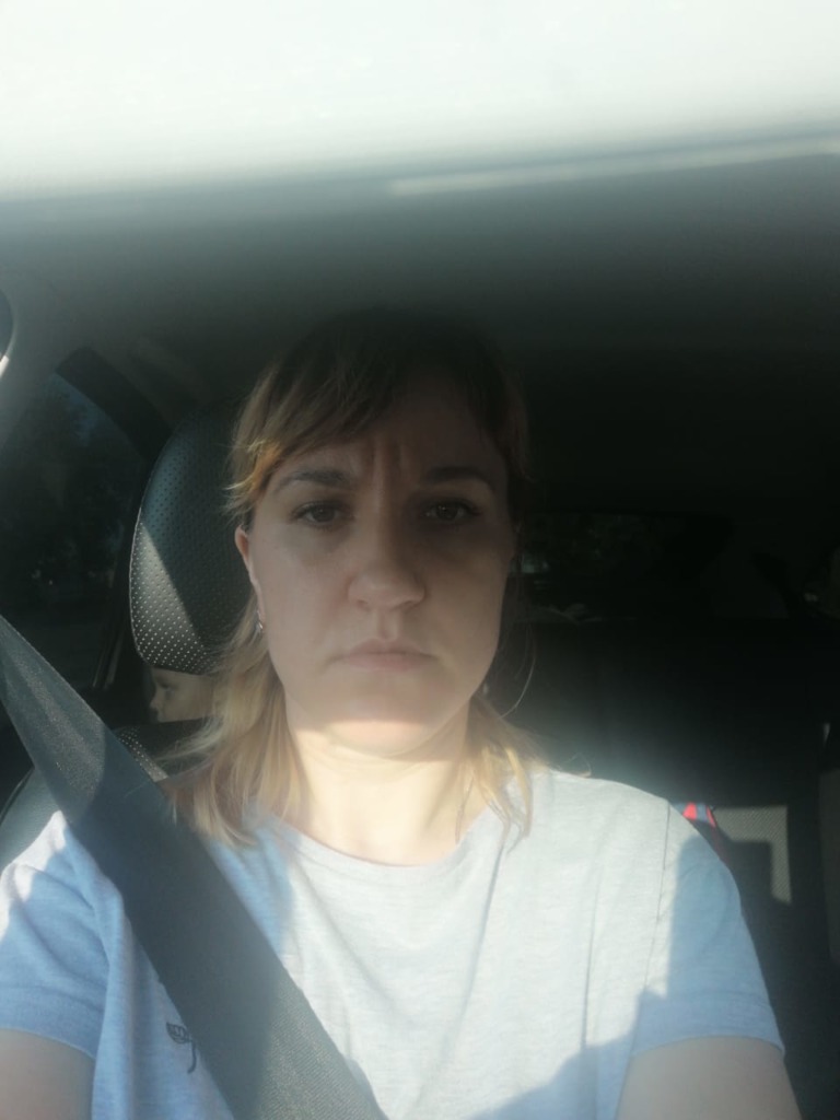 Фото 1. Как убрать межбровную морщину?