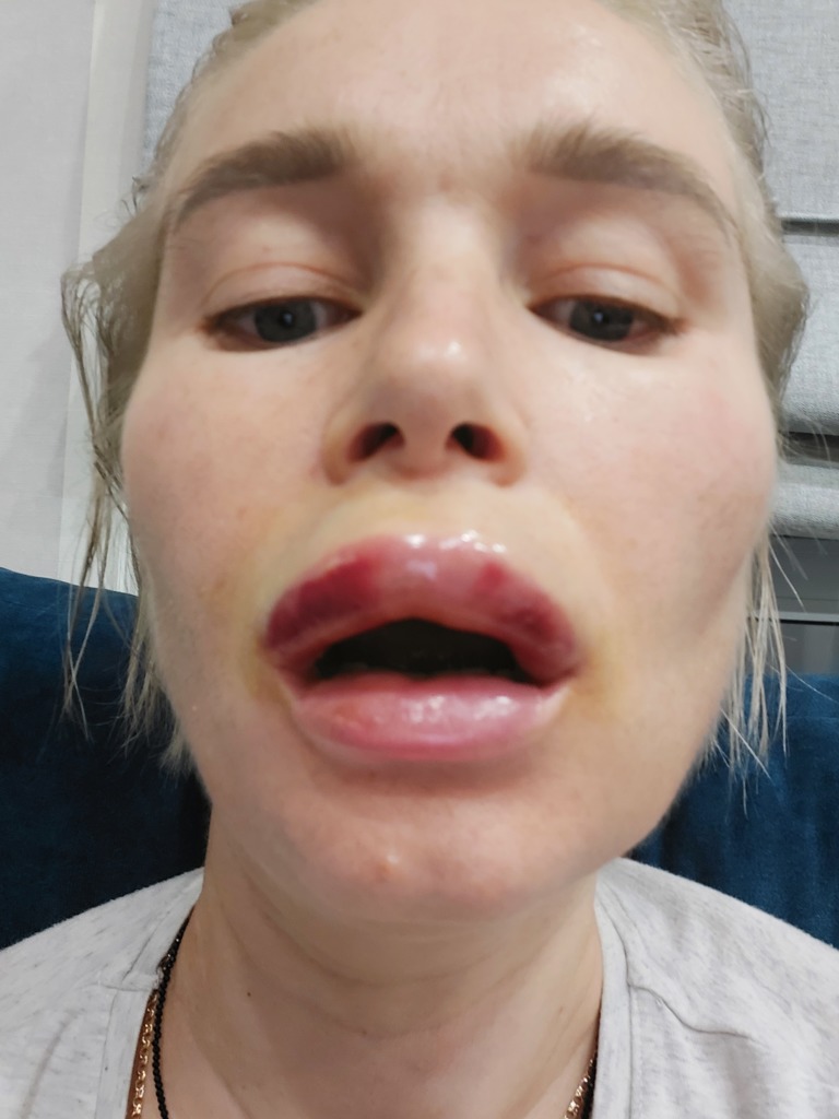 Фото 1. Подскажите,это не некроз?