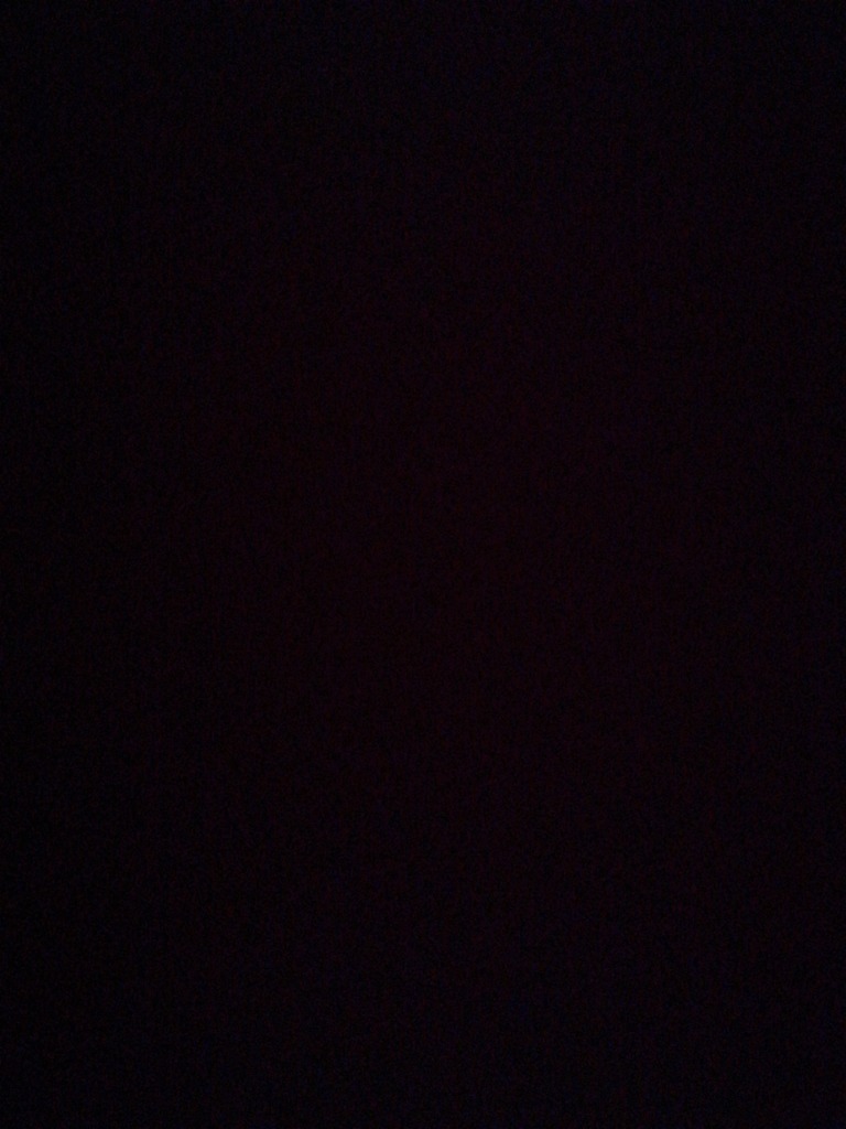 Фото 1. Можно ли увеличивать губы, если возможен рак по наследству?