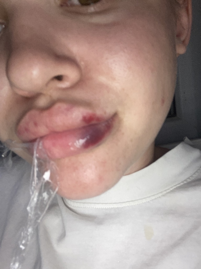 Фото 1. Может ли быть, что это ишемия?