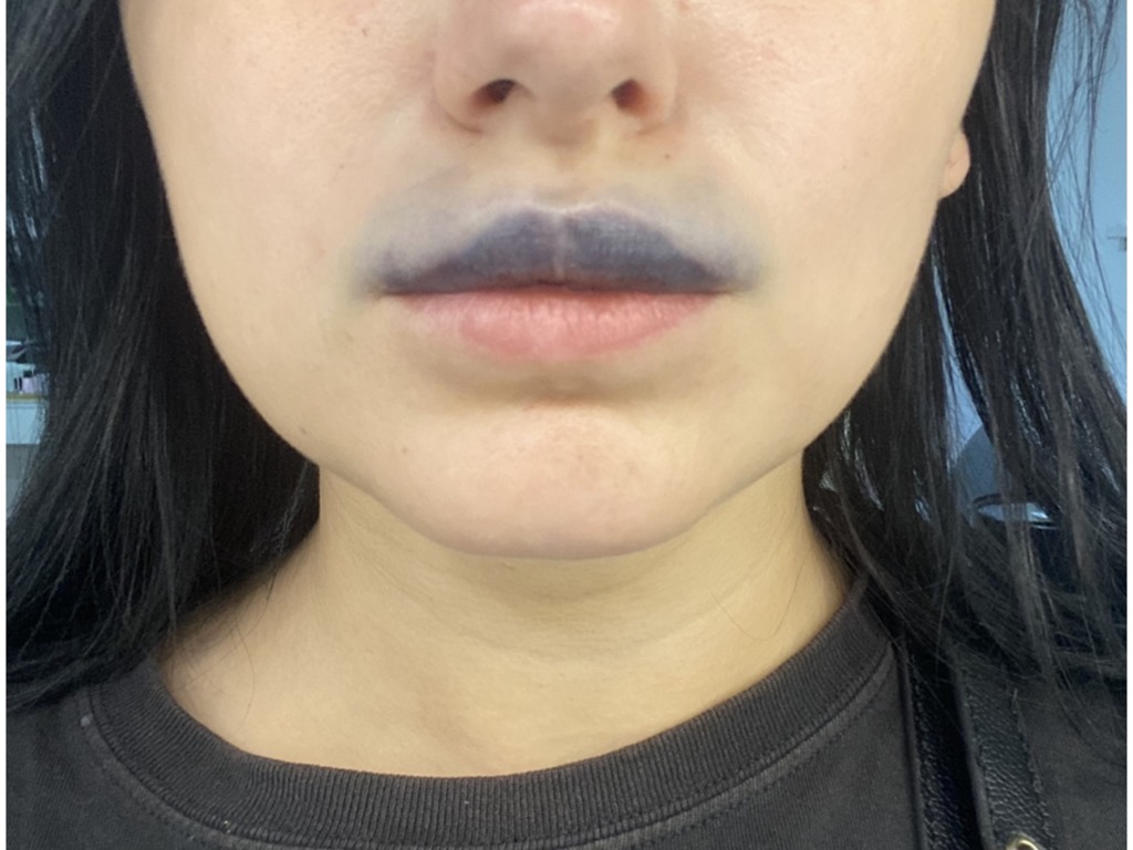 Фото 3. Подскажите, через сколько обычно такое проходит? 