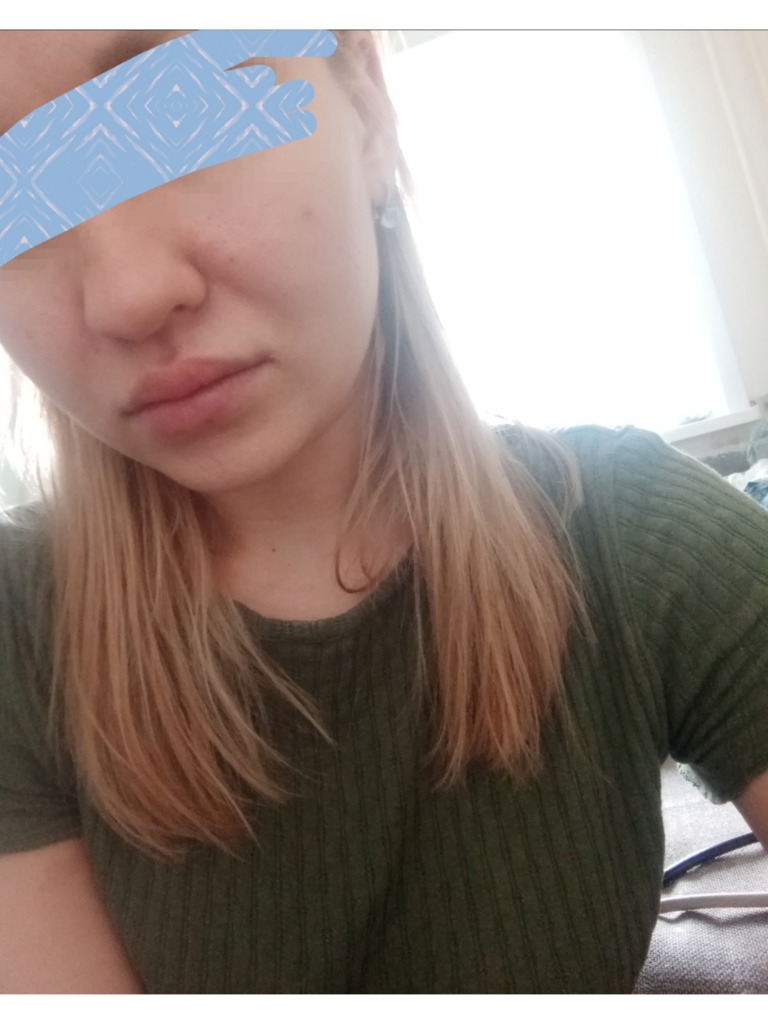 Фото 1. Как можно вернуть прежнее лицо?