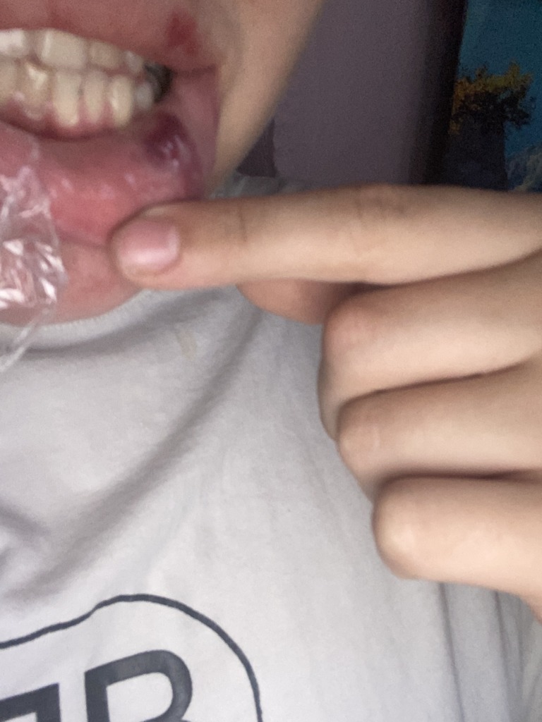 Фото 2. Может ли быть, что это ишемия?