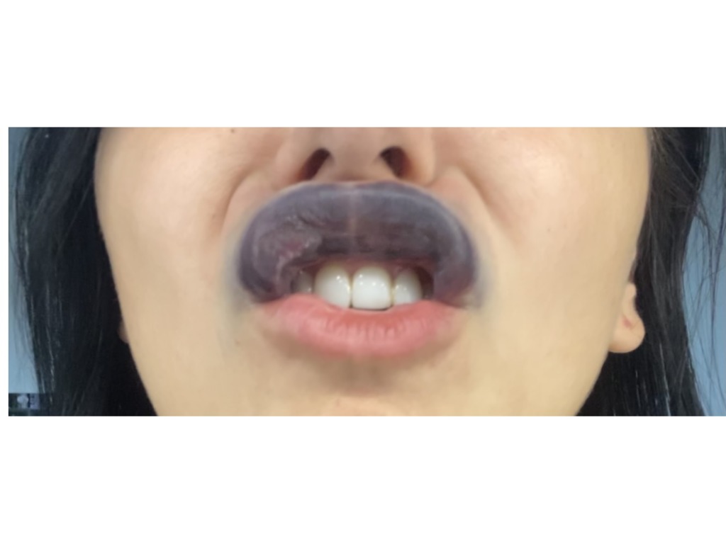 Фото 2. Подскажите, через сколько обычно такое проходит? 