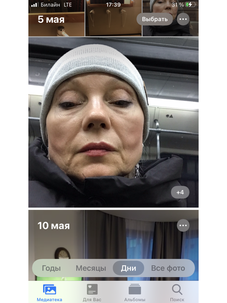 Фото 7. Как избавиться от постоянного отека?