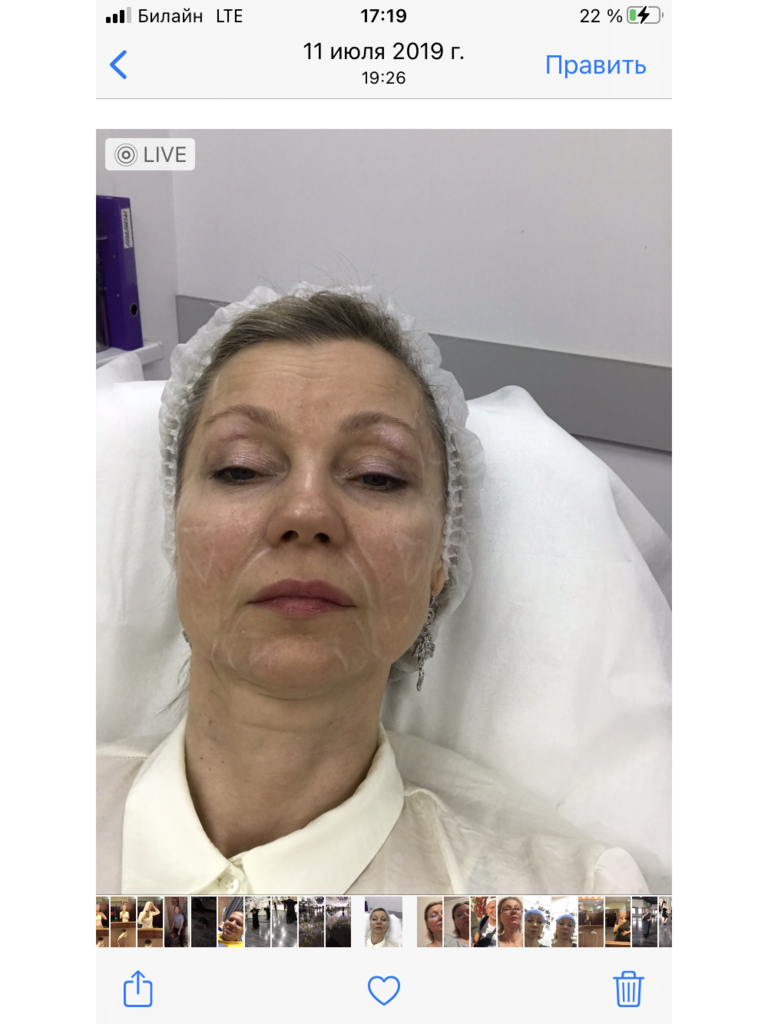 Фото 5. Как избавиться от постоянного отека?
