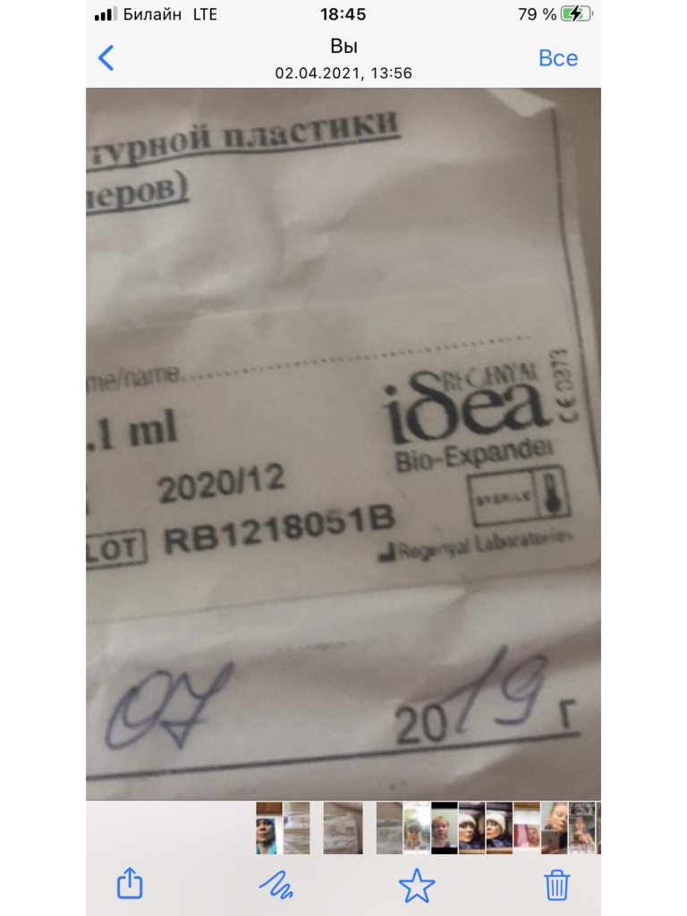 Фото 1. Как избавиться от постоянного отека?