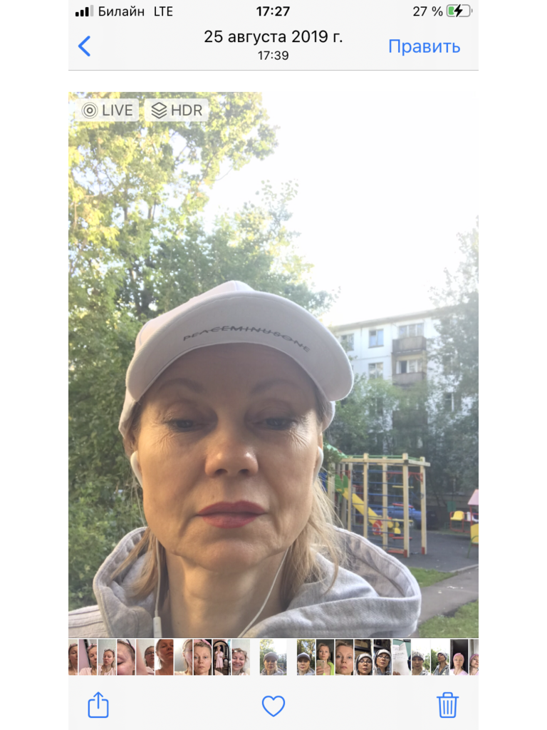 Фото 4. Как избавиться от постоянного отека?