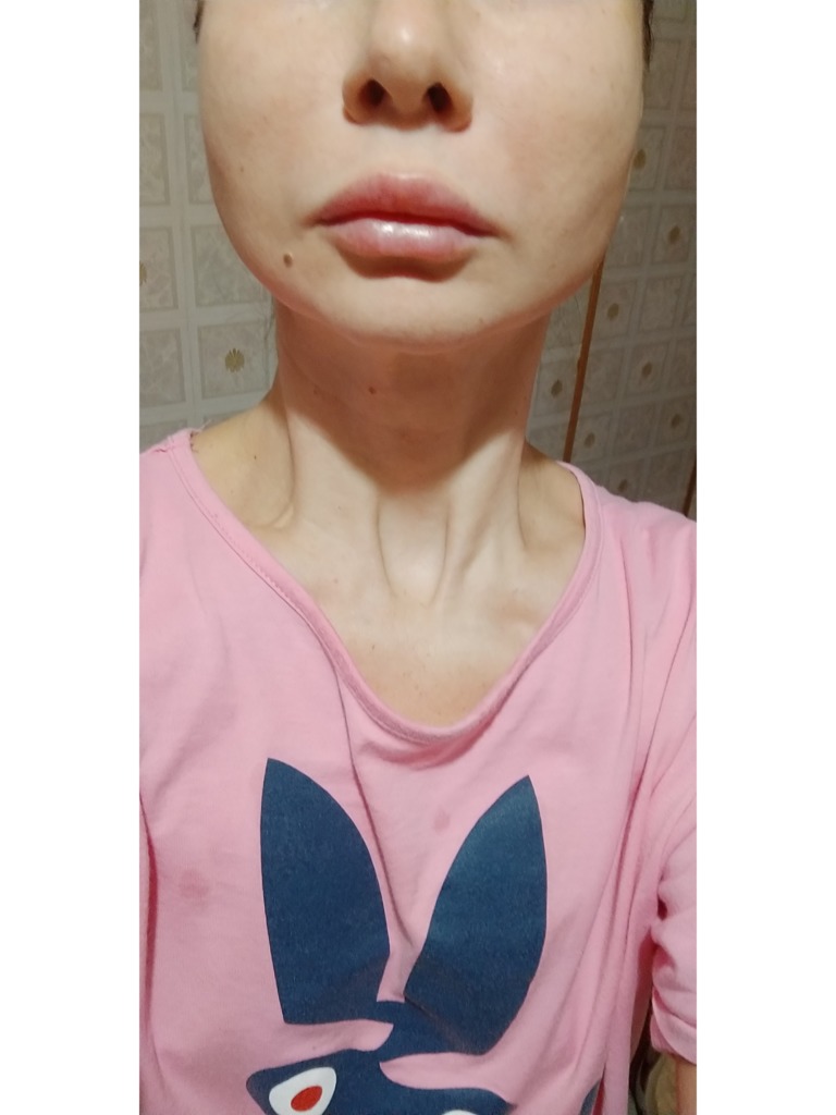 Фото 1. Как понять, что нить сорвалась?