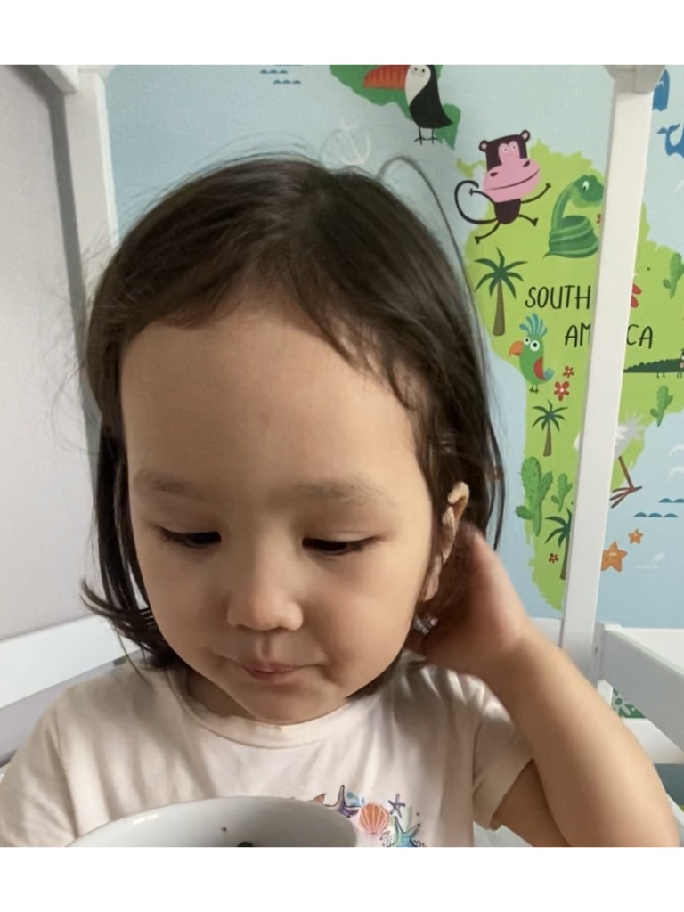 Фото 3. Как избавиться от шрама?