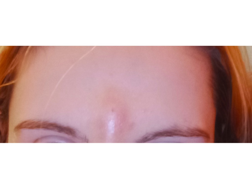 Фото 1. Может ли это быть ишемией?