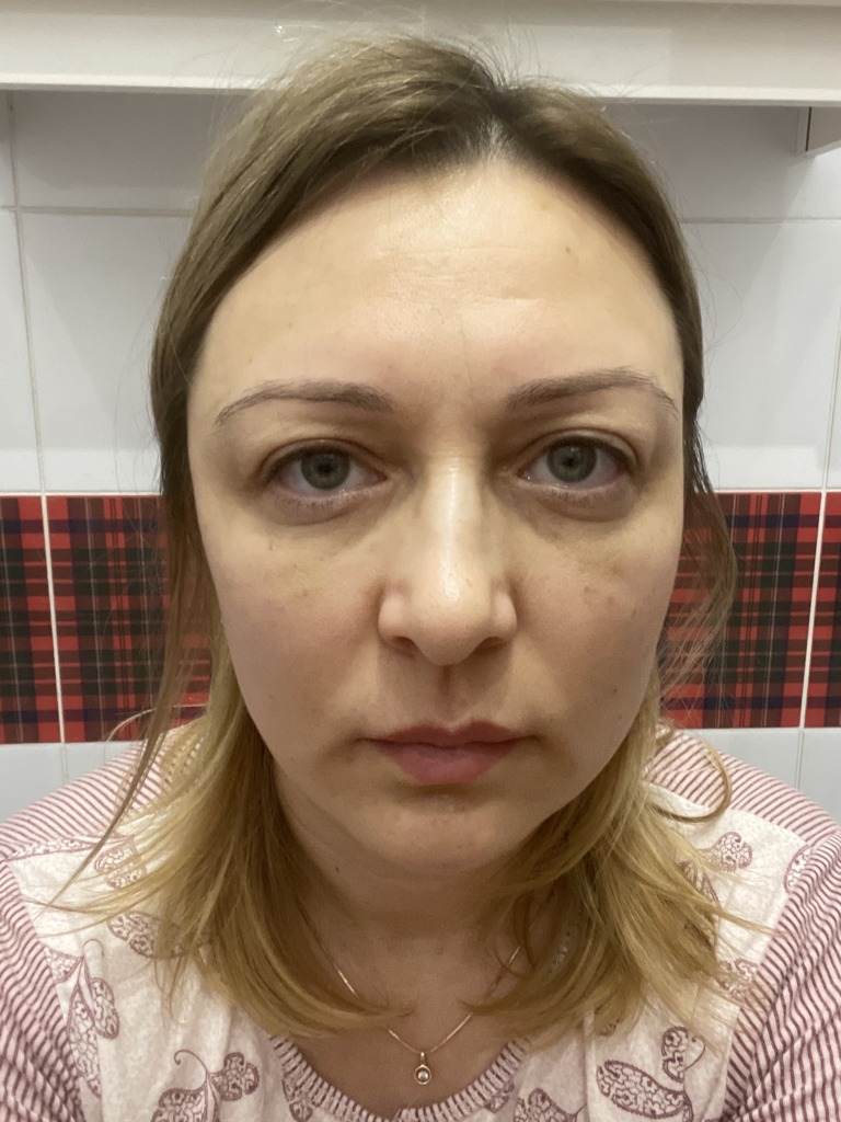 Фото 1. Что нужно начать делать, чтобы избежать осложнений?