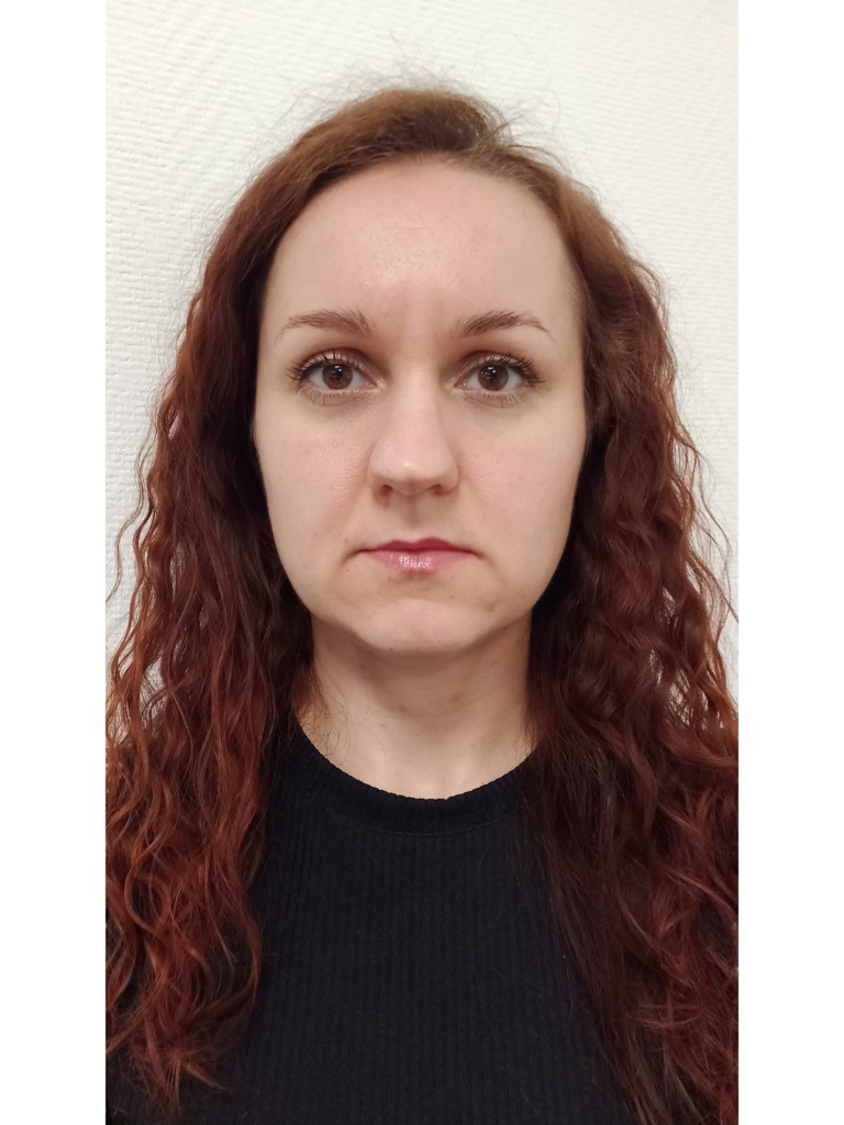 Фото 1. Какую процедуру посоветуете от межбровных морщин и носогубных складок?