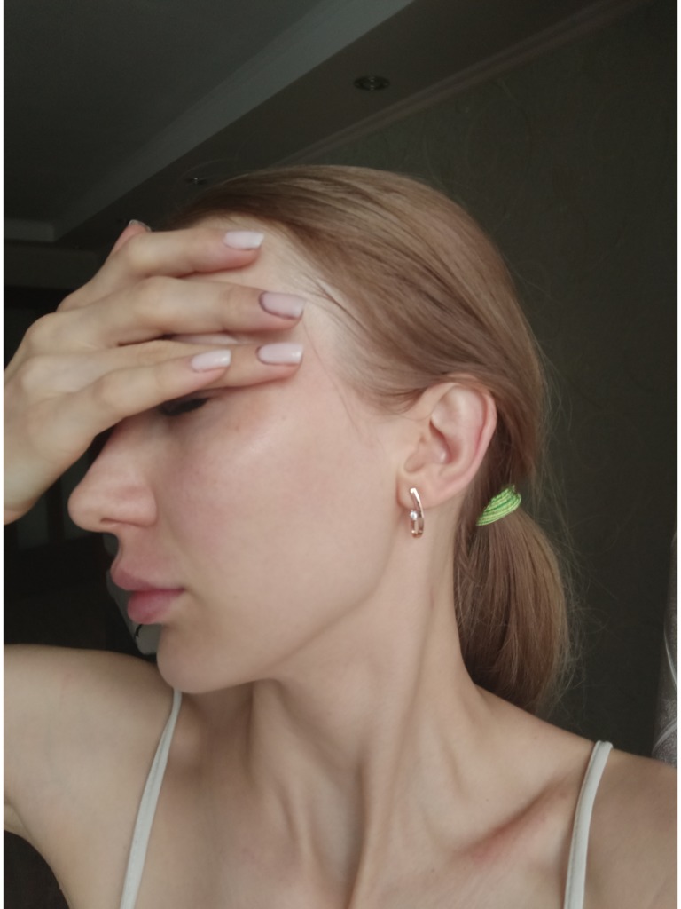 Фото 1. Белые участки после филлера это ишемия?