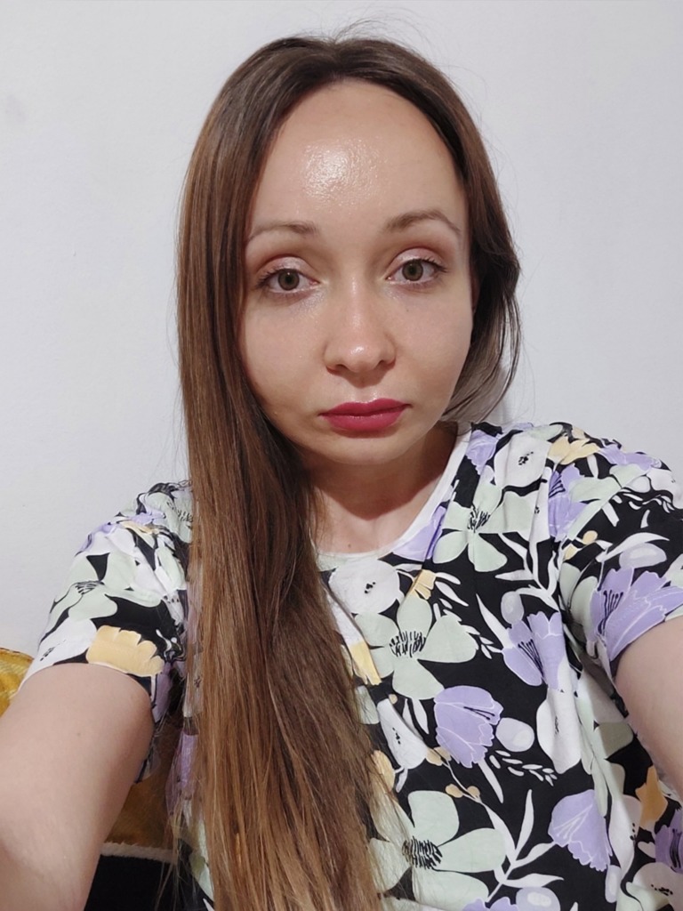 Фото 2. Как мне вернуть свое лицо и убрать эту припухлость?