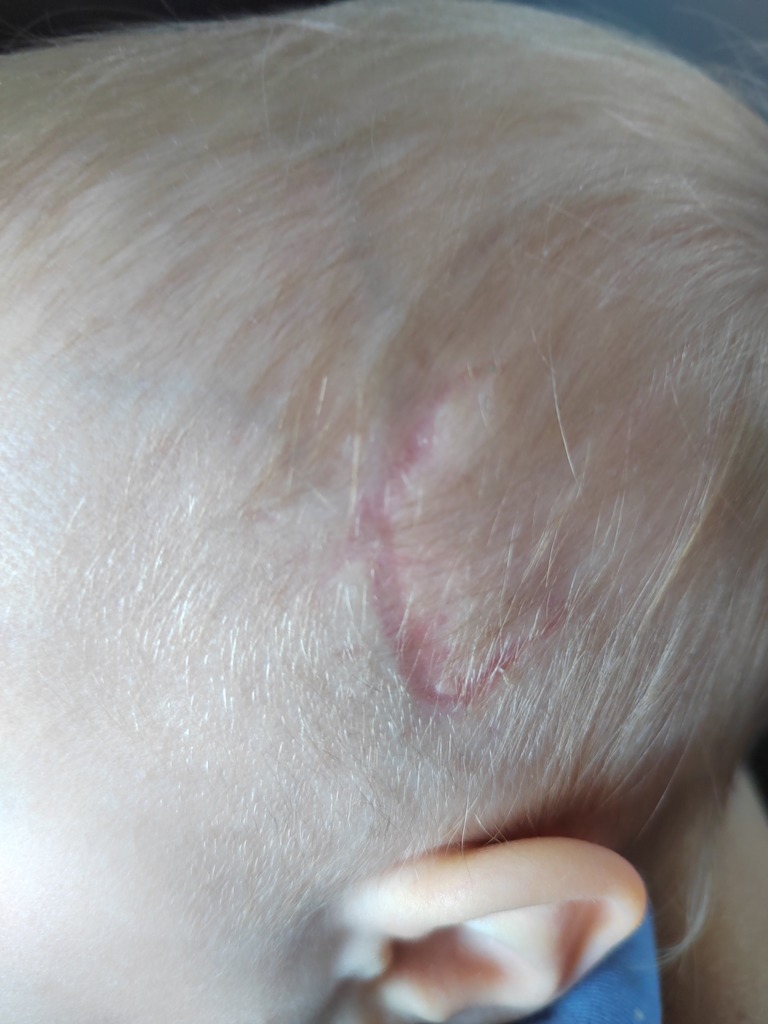 Фото 2. Сильный порез головы
