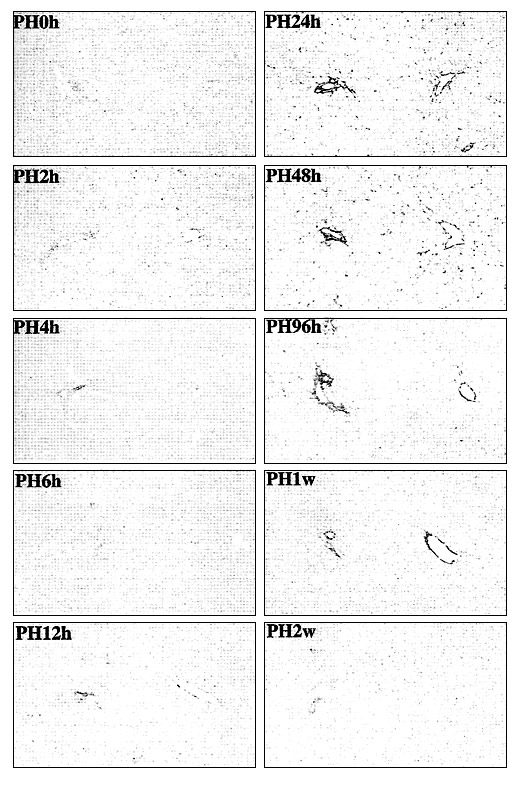 Гиалуронан во время регенерации печени