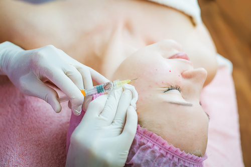 контурная пластика лица