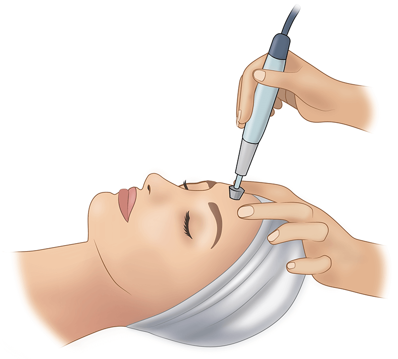 Аппаратная косметология