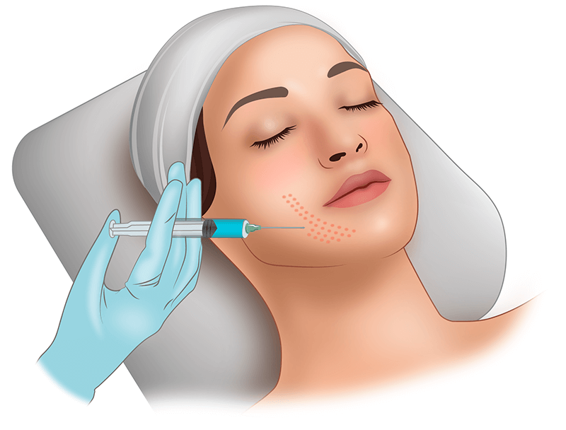 Мезотерапия лица